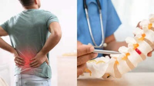 Is It a Slipped Disc? Know the Difference Between Common Back Pain and Herniated Discs