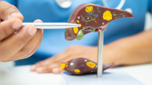 Alcoholic vs. Non-Alcoholic Fatty Liver Disease: Which Poses the Greater Threat?